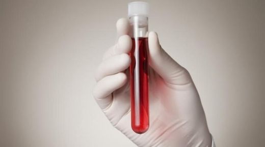 Üre Nedir Üre Yüksekliği ve Düşüklüğü Nedir?